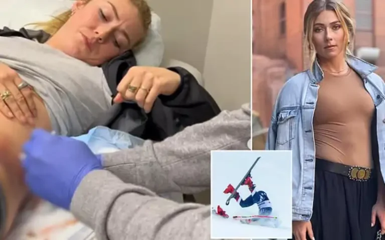 What caused Mikaela Shiffrin's injury